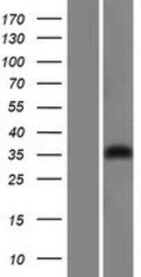 Western Blot: GIPC1 Overexpression Lysate [NBL1-11081]