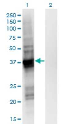 Western Blot: GIPC2 Antibody (4H8) [H00054810-M02]