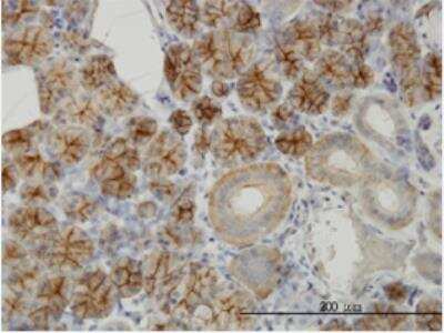 Immunohistochemistry-Paraffin: GIPC2 Antibody [H00054810-B01P]