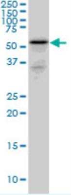Western Blot: GIPC2 Antibody [H00054810-B01P]