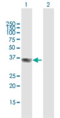 Western Blot: GIPC2 Antibody [H00054810-B01P]