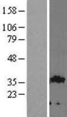 Western Blot: GIPC2 Overexpression Lysate [NBL1-11082]