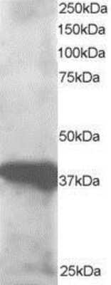 Western Blot: GIPC3 Antibody [NB100-1352]