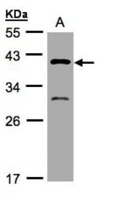 Western Blot: GIPC3 Antibody [NBP1-31178]