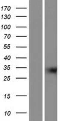 Western Blot: GIPC3 Overexpression Lysate [NBP2-05711]