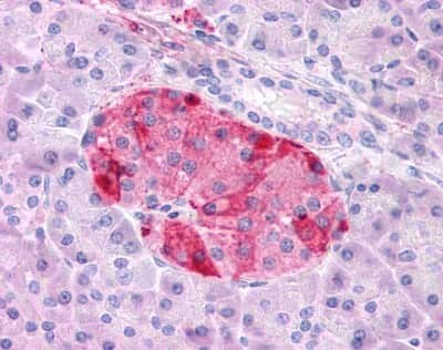 Immunohistochemistry-Paraffin: GIPR Antibody - BSA Free [NLS1250]