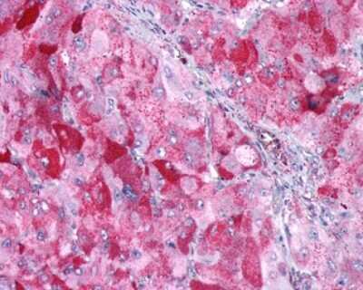 Immunohistochemistry-Paraffin: GIPR Antibody - BSA Free [NLS3840]