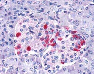 Immunohistochemistry-Paraffin: GIPR Antibody - BSA Free [NLS3842]