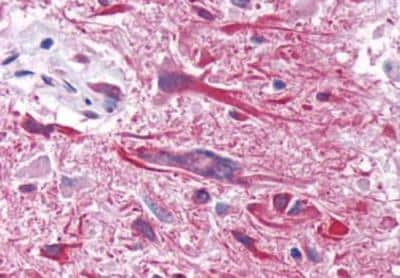 Immunohistochemistry-Paraffin: GIPR Antibody - BSA Free [NLS3842]