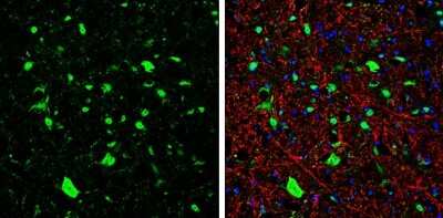 Immunohistochemistry-Frozen: GIRK2 Antibody [NBP3-13346]