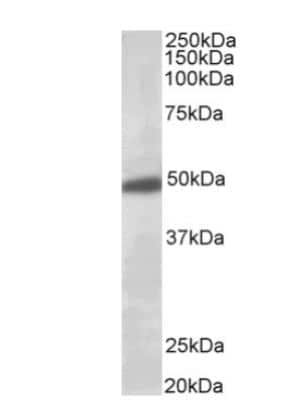 Western Blot: GIRK2 Antibody [NB100-74575]