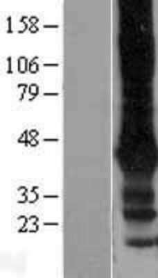 Western Blot: GIRK2 Overexpression Lysate [NBP2-04219]