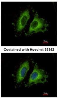 Immunocytochemistry/ Immunofluorescence: GIT1 Antibody [NBP1-31447]