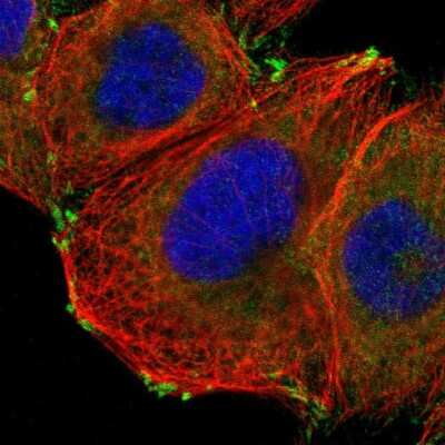 Immunocytochemistry/ Immunofluorescence: GIT1 Antibody [NBP1-86144]