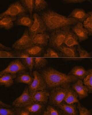 Immunocytochemistry/ Immunofluorescence: GIT1 Antibody - Azide and BSA Free [NBP3-03734]