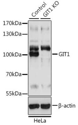 Western Blot: GIT1 Antibody - Azide and BSA Free [NBP3-03734]
