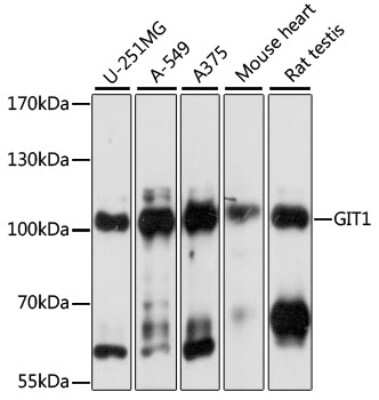 Western Blot: GIT1 Antibody - Azide and BSA Free [NBP3-03734]