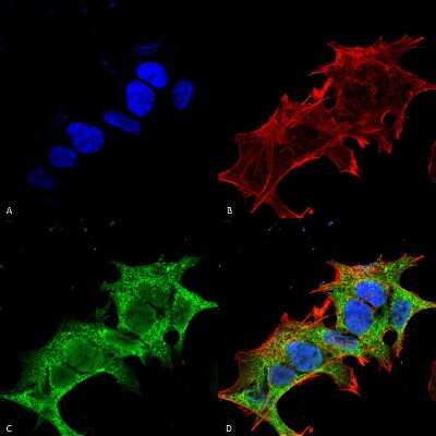 Immunocytochemistry/ Immunofluorescence: GIT1 Antibody (S39B-8) [NBP2-22423]