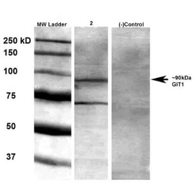 Western Blot: GIT1 Antibody (S39B-8) [NBP2-22423]