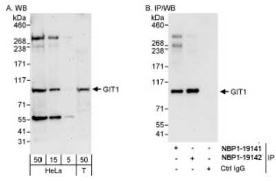 Western Blot: GIT1 Antibody [NBP1-19141]