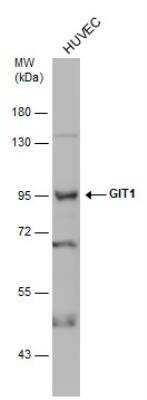 Western Blot: GIT1 Antibody [NBP1-31447]