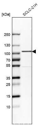 Western Blot: GIT1 Antibody [NBP1-85798]