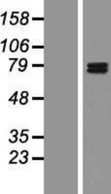 Western Blot: GIT1 Overexpression Lysate [NBP2-07386]