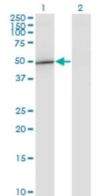 Western Blot: GIT2 Antibody (1B2) [H00009815-M04]