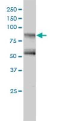 Western Blot: GIT2 Antibody (3B5-B9) [H00009815-M01]