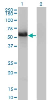 Western Blot: GIT2 Antibody (3B5-B9) [H00009815-M01]