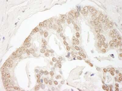 Immunohistochemistry: GIT2 Antibody [NBP1-19143]