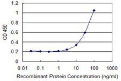 ELISA: GIT2 Antibody (M1) [H00009815-M03]