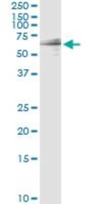 Western Blot: GIT2 Antibody (M1) [H00009815-M03]