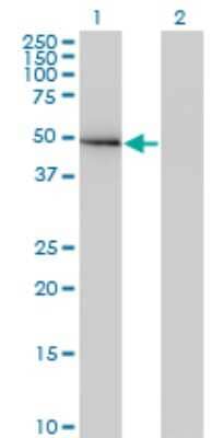 Western Blot: GIT2 Antibody (M1) [H00009815-M03]