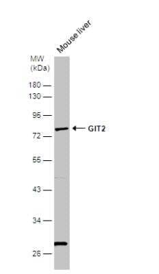 Western Blot: GIT2 Antibody [NBP2-16661]