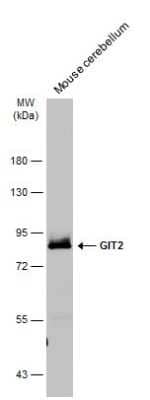 Western Blot: GIT2 Antibody [NBP3-13188]