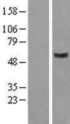 Western Blot: GIT2 Overexpression Lysate [NBL1-11084]