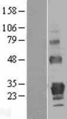 Western Blot: GITR/TNFRSF18 Overexpression Lysate [NBL1-17152]