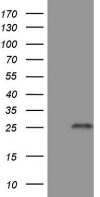 Western Blot: GITR/TNFRSF18 Antibody (OTI9G8) [NBP2-46156]