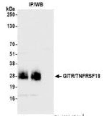 Immunoprecipitation: GITR/TNFRSF18 Antibody (BLR068G) [NBP3-14683]