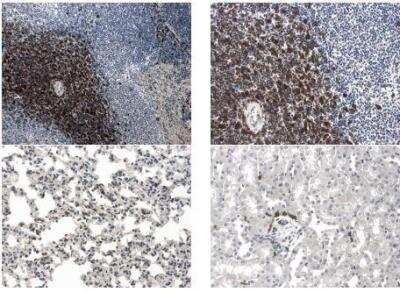 Immunohistochemistry-Paraffin: GITR/TNFRSF18 Antibody (RM0066-7C13) - Azide and BSA Free [NBP2-12338]