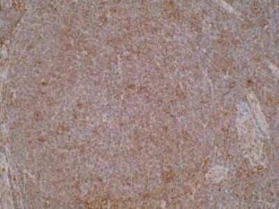 Immunohistochemistry: GITR/TNFRSF18 Antibody (T9P4G4*D7) - BSA Free [NBP2-50337]