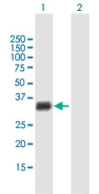 Western Blot: GIYD2 Antibody [H00079008-B01P]