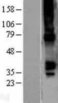 Western Blot: Connexin 40/GJA5 Overexpression Lysate [NBL1-11089]