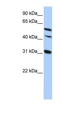 Western Blot: Connexin 50/GJA8 Antibody [NBP1-59201]