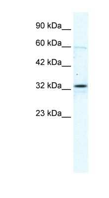 Western Blot: Connexin 32/GJB1 Antibody [NBP1-59139]