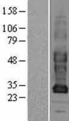 Western Blot: Connexin 31/GJB3 Overexpression Lysate [NBL1-11095]