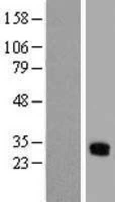 Western Blot: Connexin 31/GJB3 Overexpression Lysate [NBL1-11096]