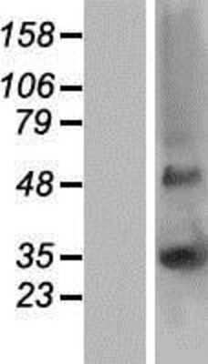 Western Blot: Connexin 30.1/GJB5 Overexpression Lysate [NBP2-07767]