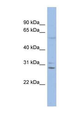 Western Blot: Connexin 30/GJB6 Antibody [NBP1-59193]